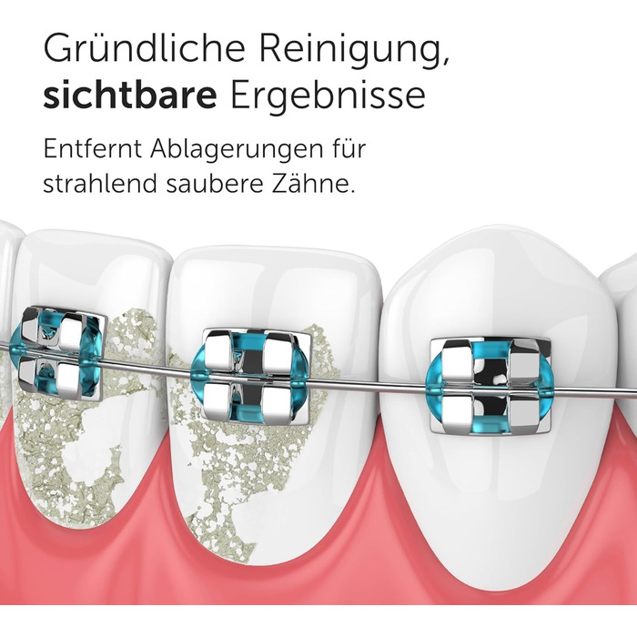 Wondersmile Munddusche PRO: Переможець тесту 2024 року, TÜV-сертифікована, 100 днів без ризику, SmoothFlow для догляду за зубами та яснами, 5 режимів, акумулятор PowerAkku (30 днів), Ultimate Black