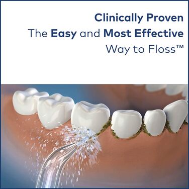 Іригатор Waterpik WP-112E1 Ultra Munddusche BLACK - для гігієни порожнини рота