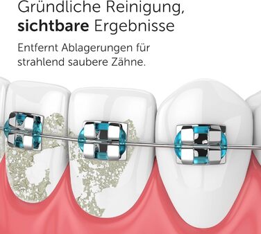 Wondersmile Munddusche PRO: Переможець тесту 2024 року, TÜV-сертифікована, 100 днів без ризику, SmoothFlow для догляду за зубами та яснами, 5 режимів, акумулятор PowerAkku (30 днів), Ultimate Black